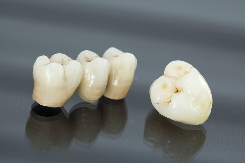 Provisional Restorations Brad Schoonover Dds